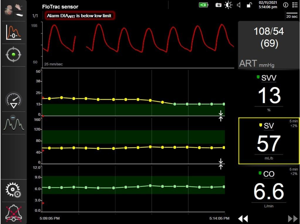 FloTrac system algorithm